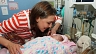 В США впервые в мире ребенок с синдромом Поттера родился живым